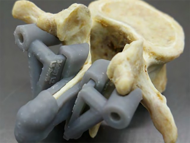3D打印技术再显神奇 未来或改变外科手术流程